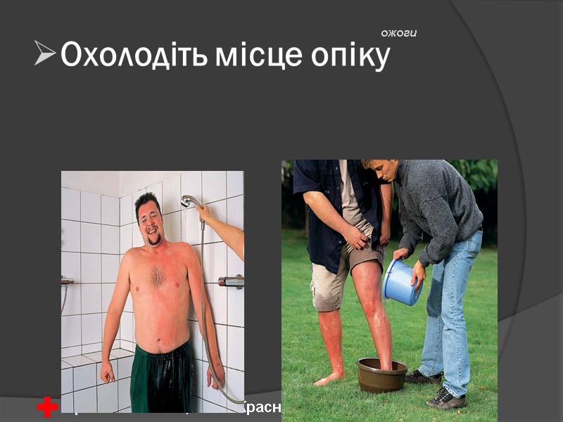 Охолодіть місце опіку